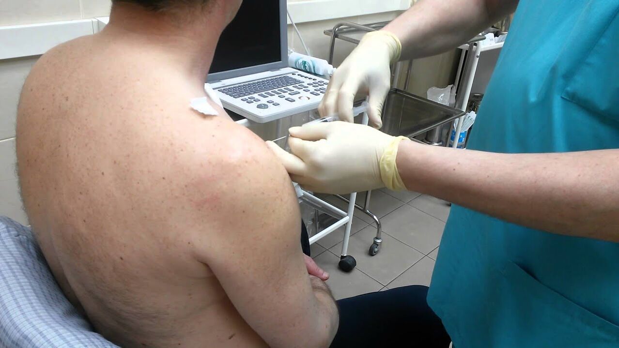 shoulder injection for osteoarthritis