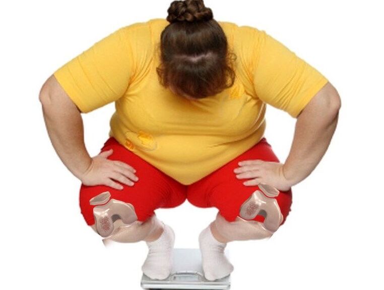 Among patients suffering from osteoarthritis, most are overweight or obese